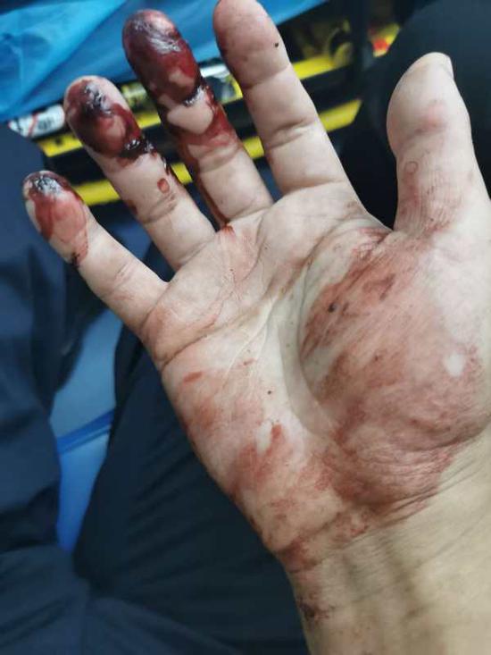 浙江高速路上车辆侧翻两人被困民警猛砸车窗1分钟内救人