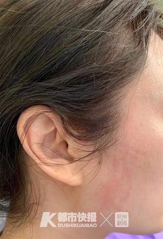 杭州姑娘199元团购染发套餐头上现蓝绿黄红四色