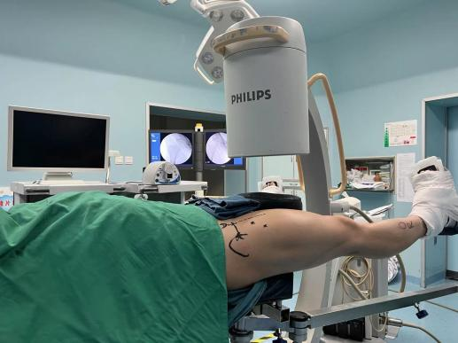 髋关节镜下FAI治疗