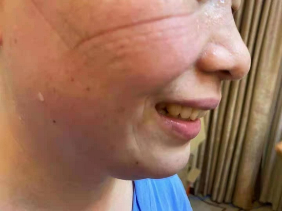 口罩的勒痕是最真实的美