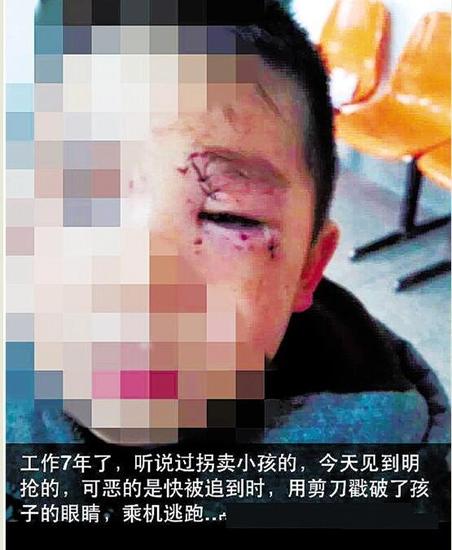 嘉兴1女子用锐器猛戳孩子眼睛