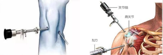 （图片来自网络）